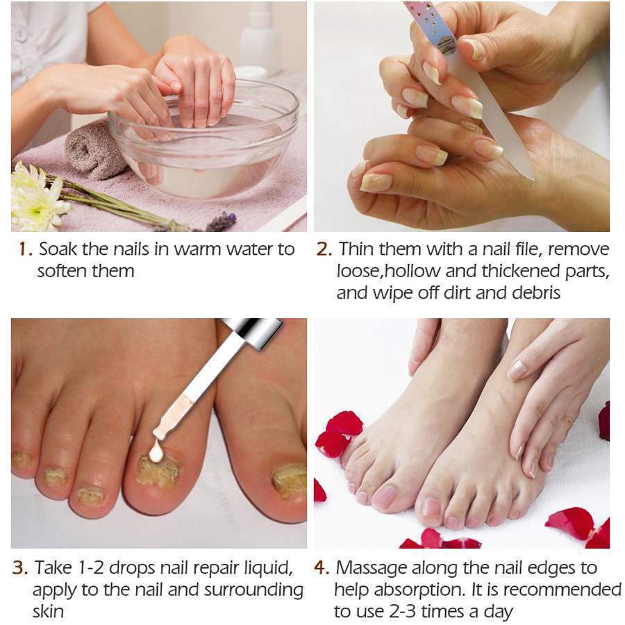 Professional Nail Repair Treatment