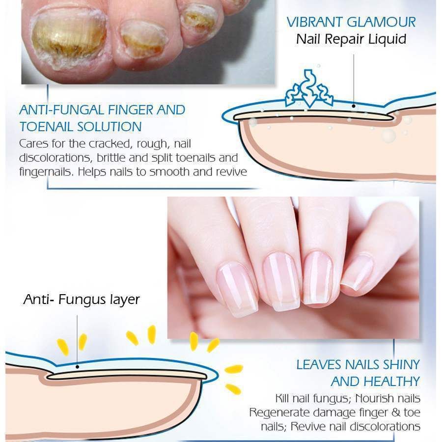 Traitement professionnel de réparation des ongles 